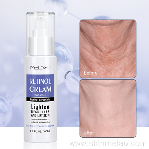 Retinol Polypeptide Skin Anti Aging Neck Cream